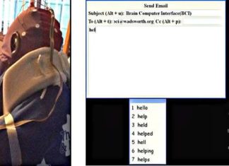 Patients with amyotrophic lateral sclerosis (ALS) can communicate using a brain-computer interface (BCI)