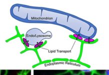 Several gene mutations have been linked to Parkinson’s disease, but exactly how and where some of them cause their damage has been unclear