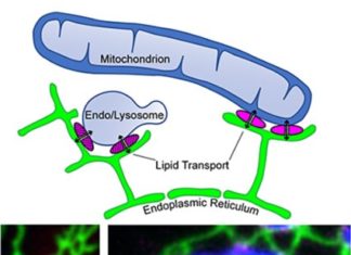 Several gene mutations have been linked to Parkinson’s disease, but exactly how and where some of them cause their damage has been unclear