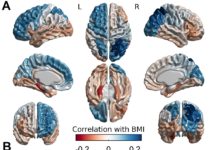 How obesity is genetically intertwined with brain structure and mental performance