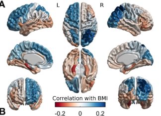 How obesity is genetically intertwined with brain structure and mental performance