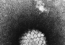 Infection rates of high risk human papillomavirus (HR-HPV) oral infection in England are lower than expected