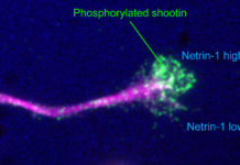 Japanese and American scientists report that the molecule shootin1 is essential for guiding the axon to its final destination