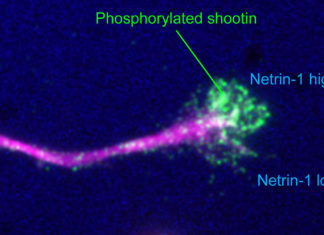 Japanese and American scientists report that the molecule shootin1 is essential for guiding the axon to its final destination
