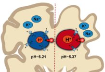 Johns Hopkins Medicine scientists say that pH imbalance in brain cells may contribute to Alzheimer’s disease