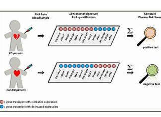 Kawasaki Disease (KD) can be accurately diagnosed on the basis of the pattern of host gene expression in whole blood