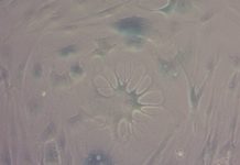 Key aspects of the ageing of human cells can be reversed by new compounds developed at the University of Exeter