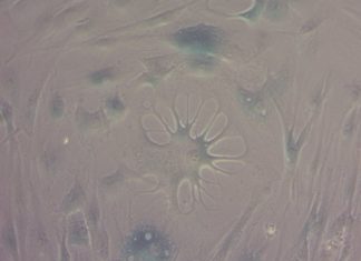 Key aspects of the ageing of human cells can be reversed by new compounds developed at the University of Exeter