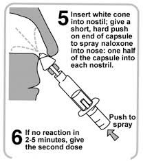Single-step nasal spray naloxone is the easiest to deliver