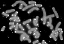 People with a cardiomyopathy have abnormally short telomeres in heart muscle cells responsible for contraction
