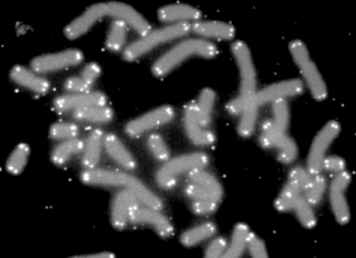 People with a cardiomyopathy have abnormally short telomeres in heart muscle cells responsible for contraction