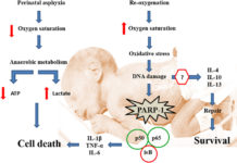 Oxygen deprivation associated with preterm birth leaves telltale signs on the brains of newborns in the form of alterations to cerebellar white matter at the cellular and the physiological levels