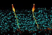 Researchers have identified a rare cell type in airway tissue, previously uncharacterized in the scientific literature, that appears to play a key role in the biology of cystic fibrosis