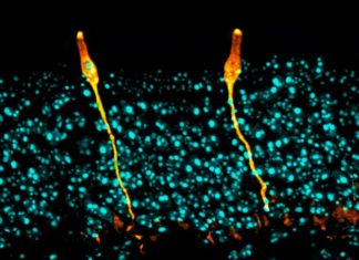 Researchers have identified a rare cell type in airway tissue, previously uncharacterized in the scientific literature, that appears to play a key role in the biology of cystic fibrosis