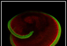 Scientists at Harvard Medical School identity of the sensor protein responsible for hearing and balance