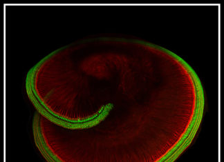 Scientists at Harvard Medical School identity of the sensor protein responsible for hearing and balance