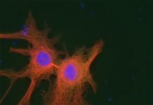 The PLK1 gene, which has for decades been considered a tumor promoter, can also halt the development of cancer