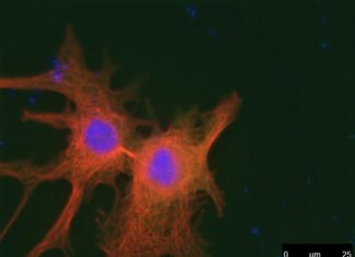 The PLK1 gene, which has for decades been considered a tumor promoter, can also halt the development of cancer