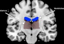 Dehydration alters human brain shape and activity, slackens task performance