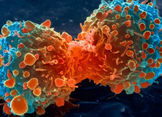 Scientists have discovered that some childhood bone cancers start growing years before they are currently diagnosed