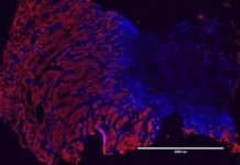 Inflammation from chronic skin injury can trigger cancer-causing mutations as well by a totally distinct mechanism