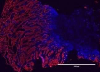 Inflammation from chronic skin injury can trigger cancer-causing mutations as well by a totally distinct mechanism
