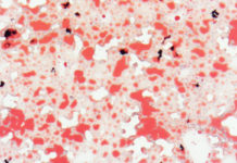 natural sugar called trehalose blocks glucose from the liver and activates a gene that boosts insulin sensitivity, reducing the chance of developing diabetes