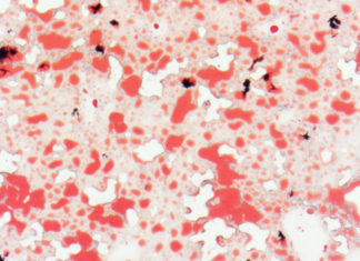 natural sugar called trehalose blocks glucose from the liver and activates a gene that boosts insulin sensitivity, reducing the chance of developing diabetes