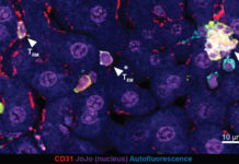 A team of researchers developed a new approach to battling malaria – boosting an immune response in the liver