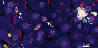 A team of researchers developed a new approach to battling malaria – boosting an immune response in the liver