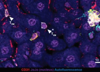 A team of researchers developed a new approach to battling malaria – boosting an immune response in the liver