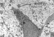 A trio of concerned scientists is issuing a warning regarding use of the phrase “mesenchymal stem cells”