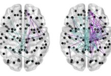 Babies born before their due date show better brain development when fed breast milk rather than formula