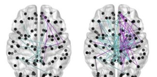 Babies born before their due date show better brain development when fed breast milk rather than formula