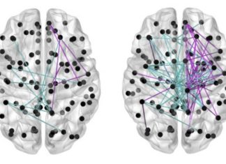 Babies born before their due date show better brain development when fed breast milk rather than formula