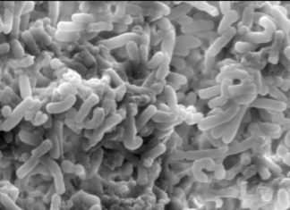 Bacterium Clostridium difficile : How bad bacteria gain an edge in the gut