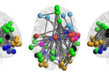 Brains of people at risk of psychosis exhibit a pattern that can help predict whether they will go on to develop full-fledged schizophrenia