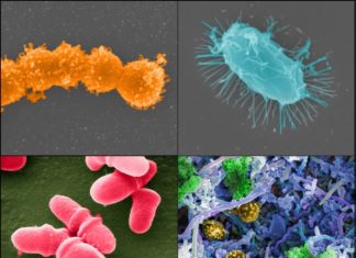 Cancer : Fecal microbiota transplantation helps restore beneficial bacteria