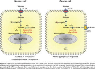 University of Colorado Cancer Center : Cancer hijacks the microbiome to glut itself on glucose