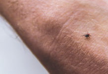 Chigger bites may cause allergic reaction to red meat