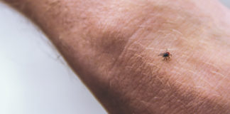 Chigger bites may cause allergic reaction to red meat