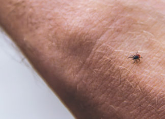 Chigger bites may cause allergic reaction to red meat