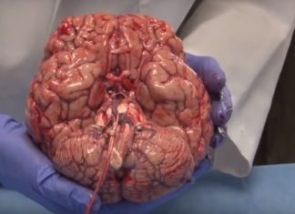 Human brain : Amazing video of a freshly removed human brain