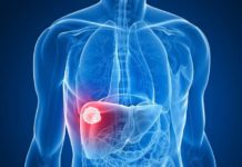 Liver cancer : Cell environment influences type of liver tumor