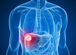 Liver cancer : Cell environment influences type of liver tumor
