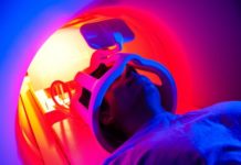 Overlooked signal in MRI scans reveal how many and which brain cells are present and show where cells have been lost through injury or disease