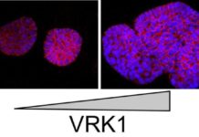 Protein called vaccinia-related kinase 1 (VRK1) may one day serve as a biomarker of aggressive cancers