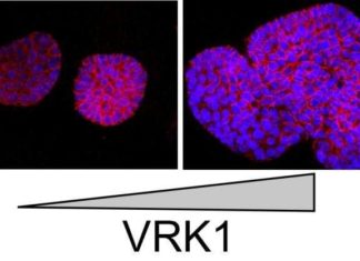 Protein called vaccinia-related kinase 1 (VRK1) may one day serve as a biomarker of aggressive cancers