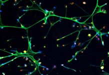 Scientists at Cold Spring Harbor Laboratory (CSHL) have determined one of the ways in which cancers in remission can spring back into action