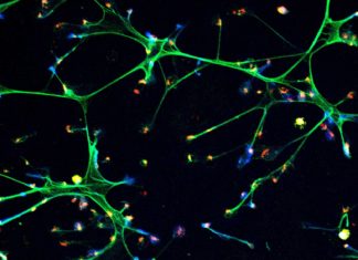 Scientists at Cold Spring Harbor Laboratory (CSHL) have determined one of the ways in which cancers in remission can spring back into action